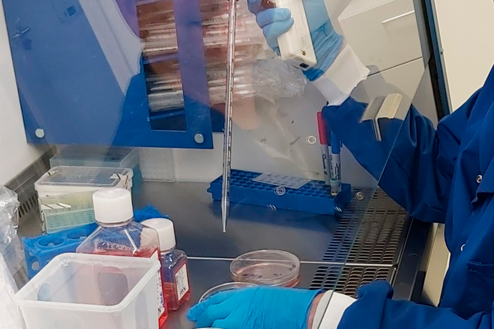 Los investigadores han conseguido aislar por primera vez el virus Lloviu, pariente cercano del Ébola.