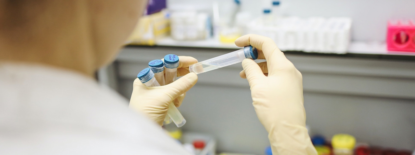 Ya son 54 los laboratorios que se ponen a disposición de las comunidades autónomas para realizar pruebas, que determinan si una persona está infectada o no con coronavirus.