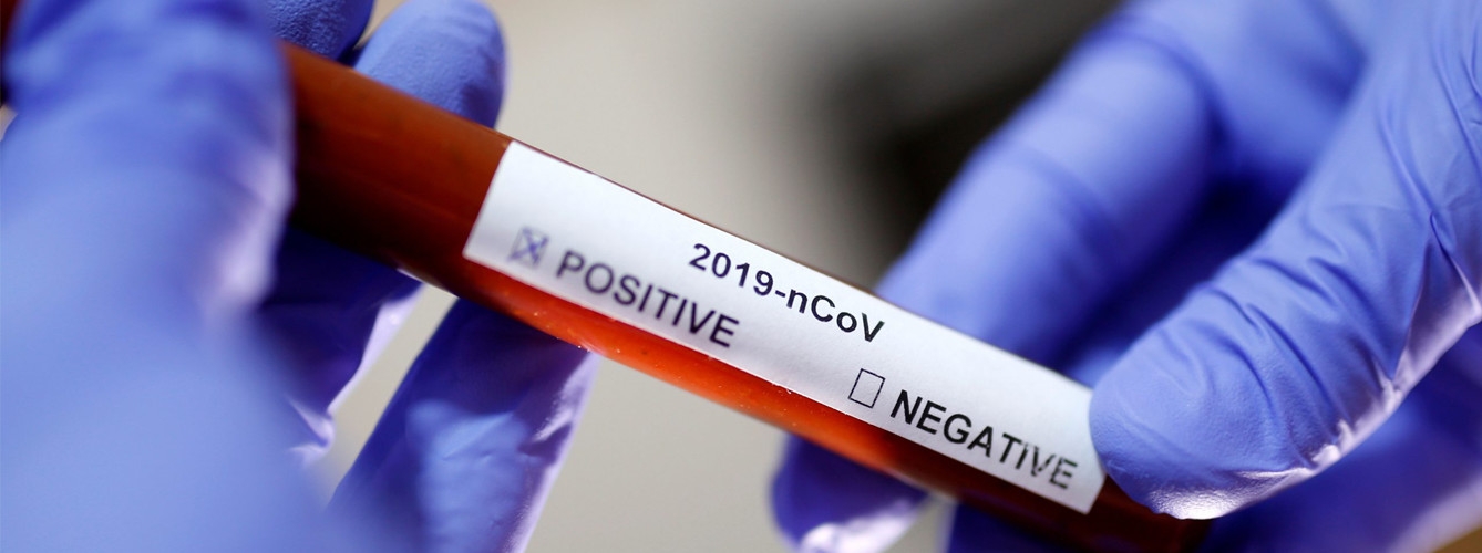 Un nuevo test de sangre al perro pomerania con coronavirus da positivo