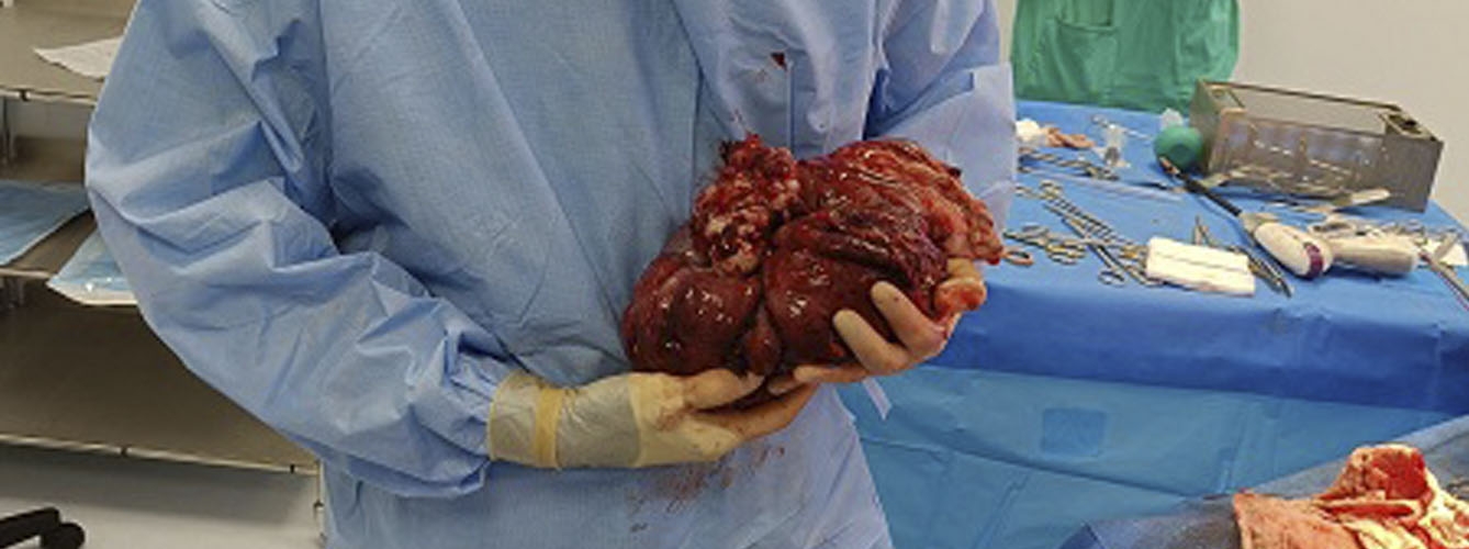 La enorme masa se había originado en el riñón derecho de la dálmata.